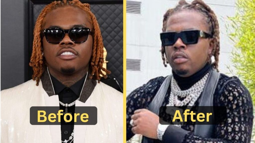 Gunna's Weight Loss: Diet Plan, Workout, Surgery, Before & After ...